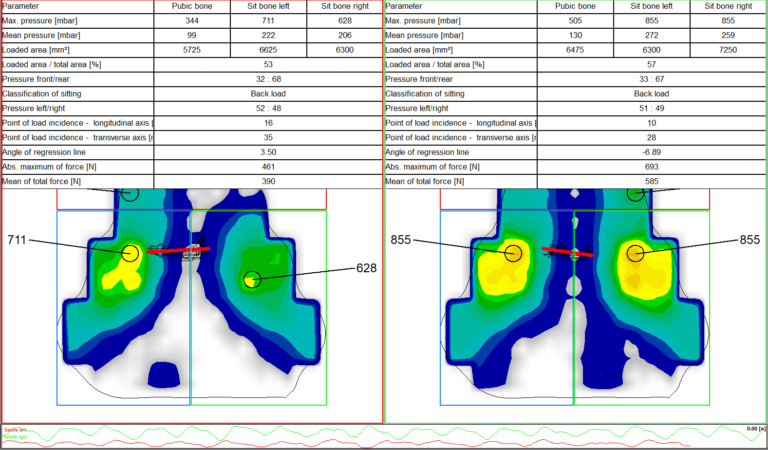 saddle pressure map